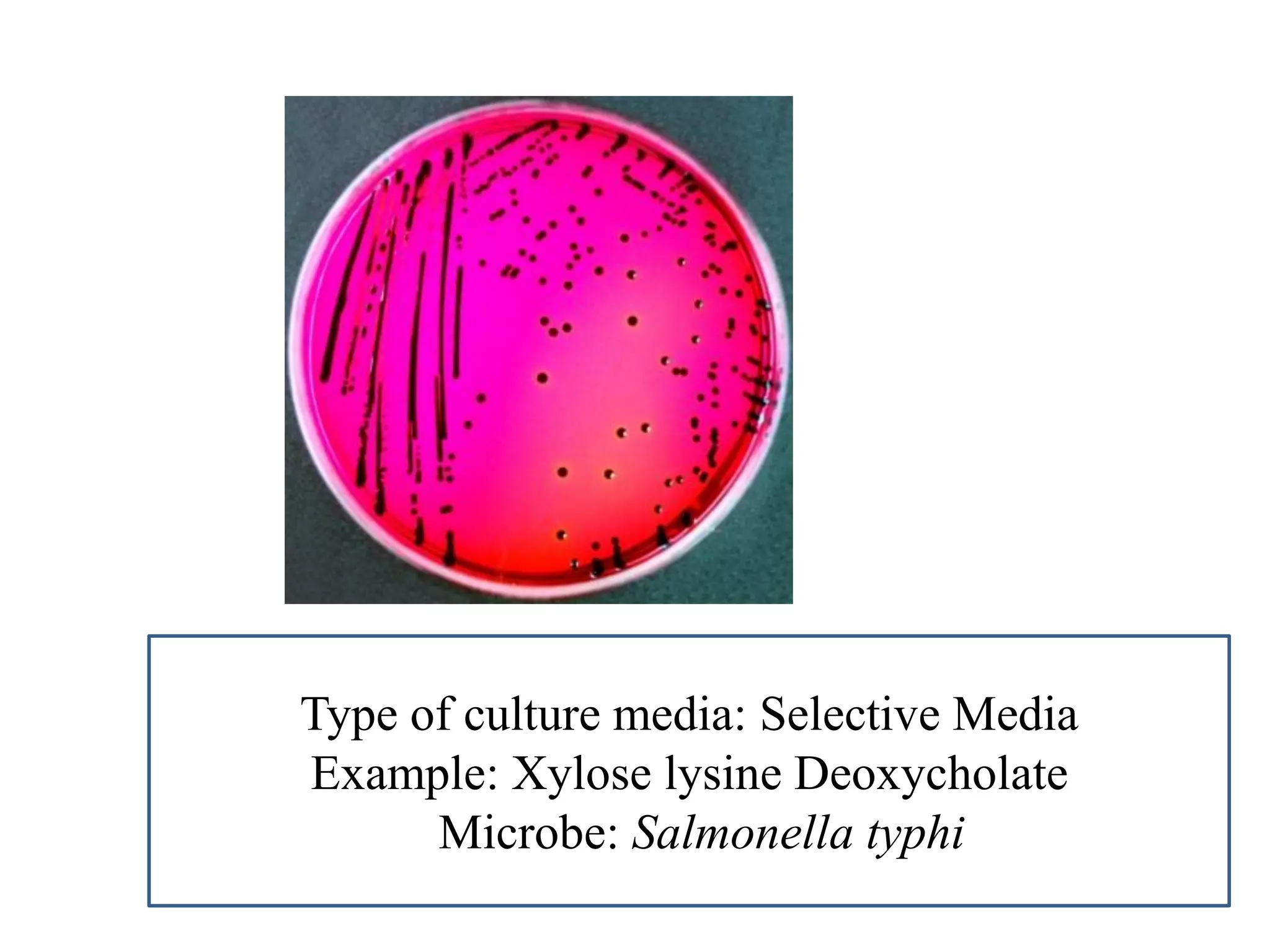 Type of culture media: Selective Media 
Example: Xylose lysine Deoxycholate 
Microbe: Salmonella typhi  
