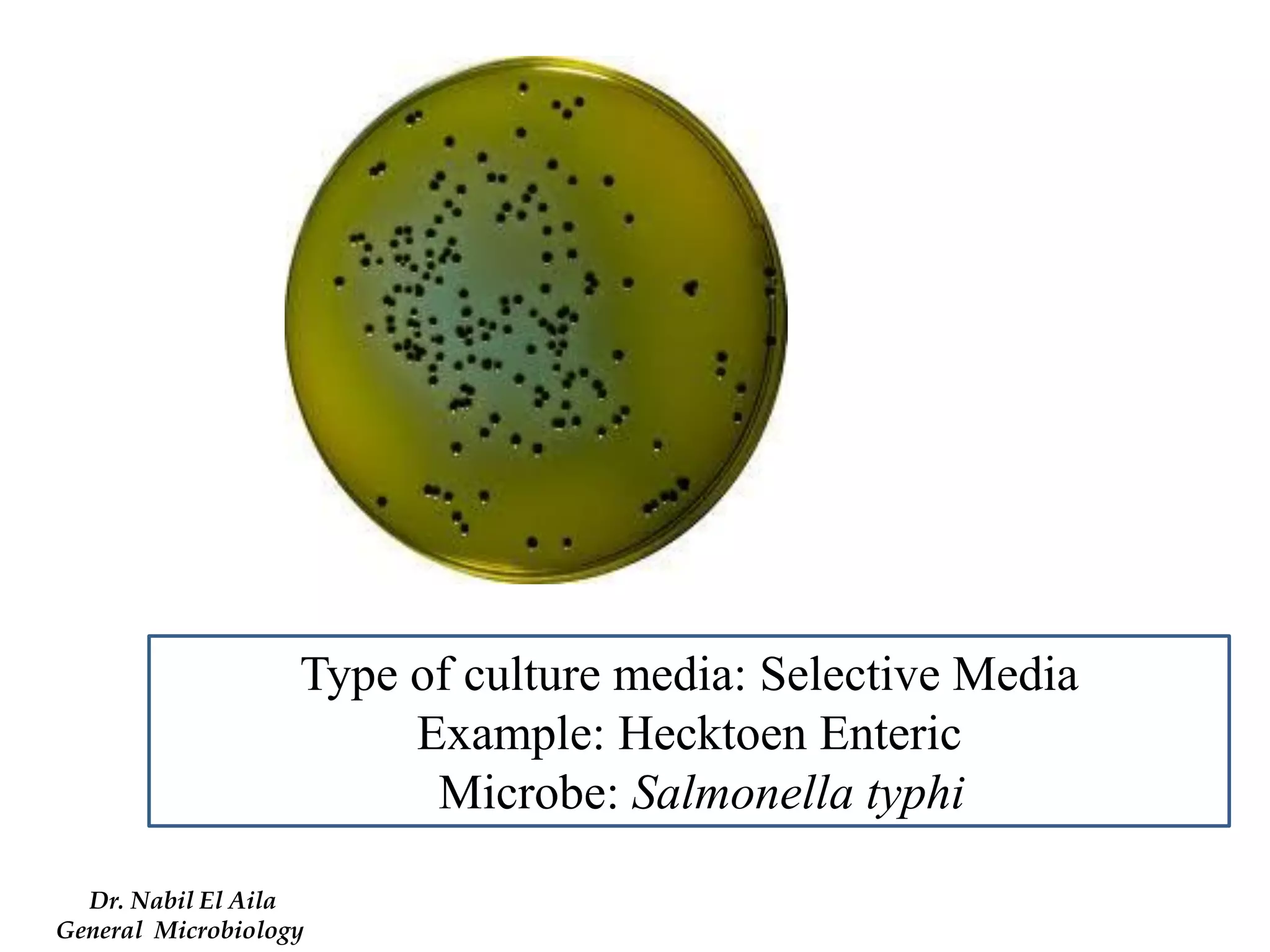 Type of culture media: Selective Media 
Example: Hecktoen Enteric 
Microbe: Salmonella typhi 
Dr. Nabil El Aila 
General Microbiology  