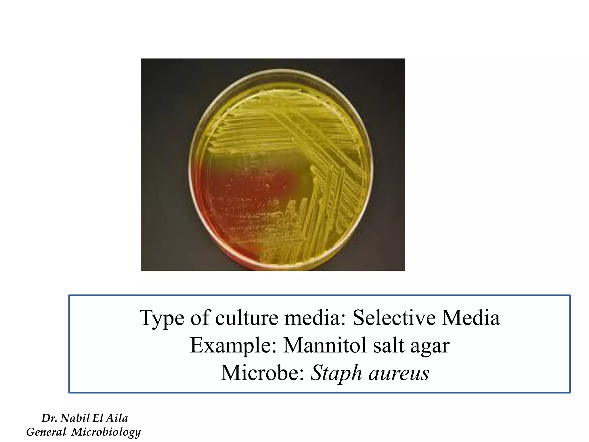 Type of culture media: Selective Media 
Example: Mannitol salt agar 
Microbe: Staph aureus 
Dr. Nabil El Aila 
General Microbiology  