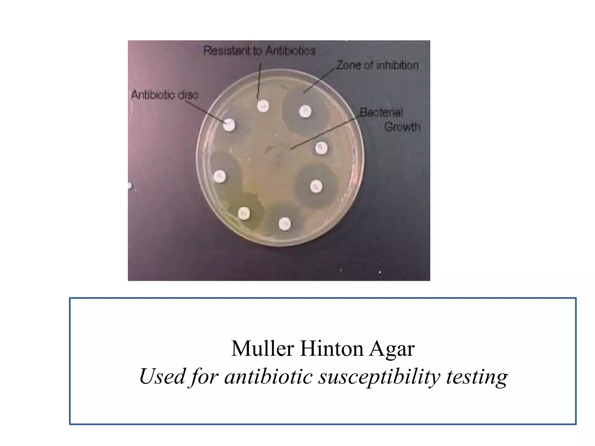 Muller Hinton Agar 
Used for antibiotic susceptibility testing  