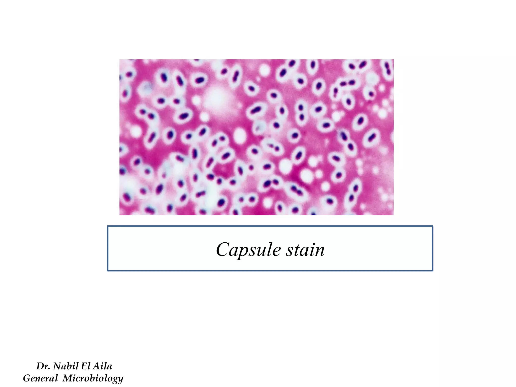 Dr. Nabil El Aila 
General Microbiology 
Capsule stain  
