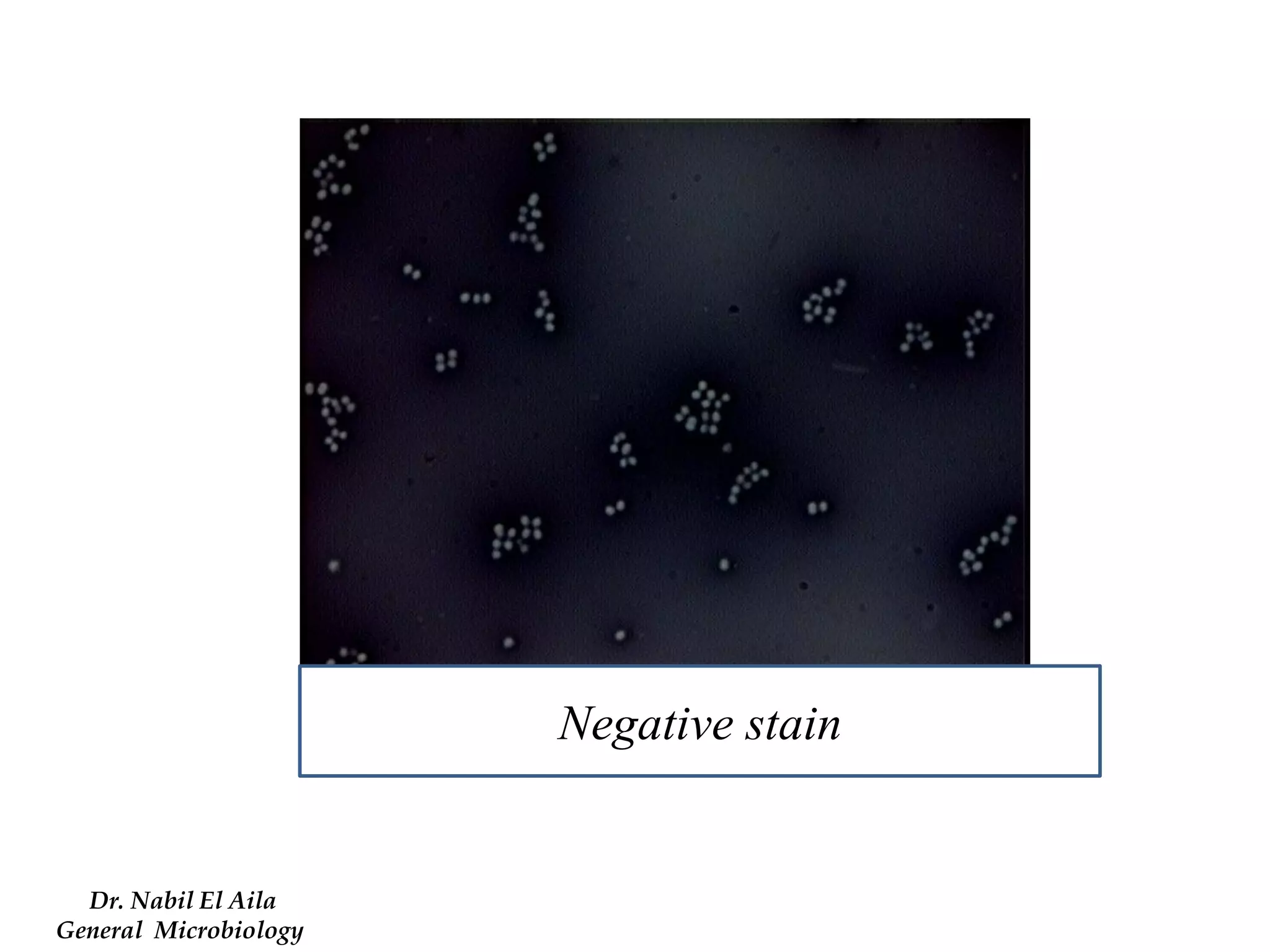 Dr. Nabil El Aila 
General Microbiology 
Negative stain  
