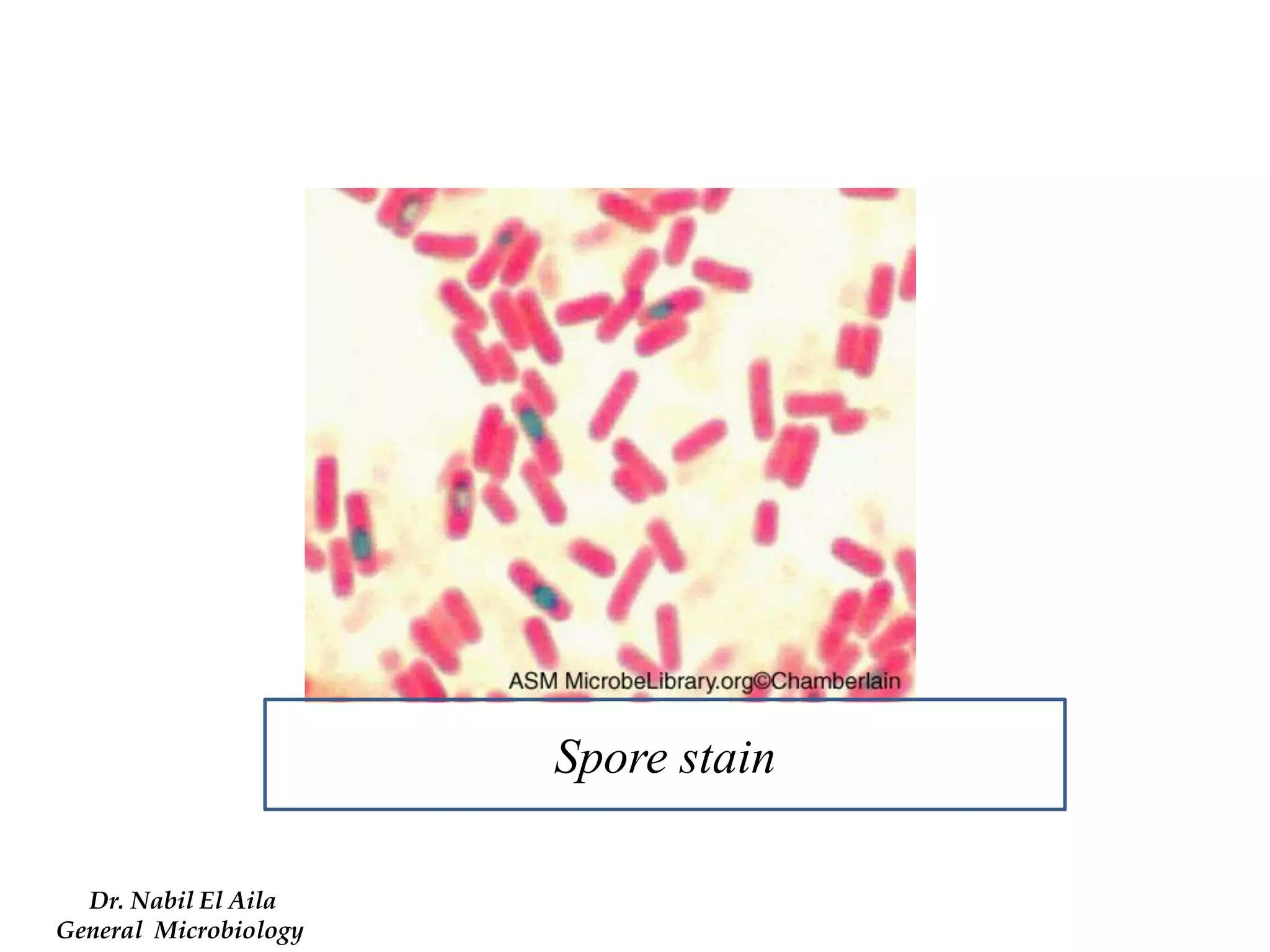 Dr. Nabil El Aila 
General Microbiology 
Spore stain  