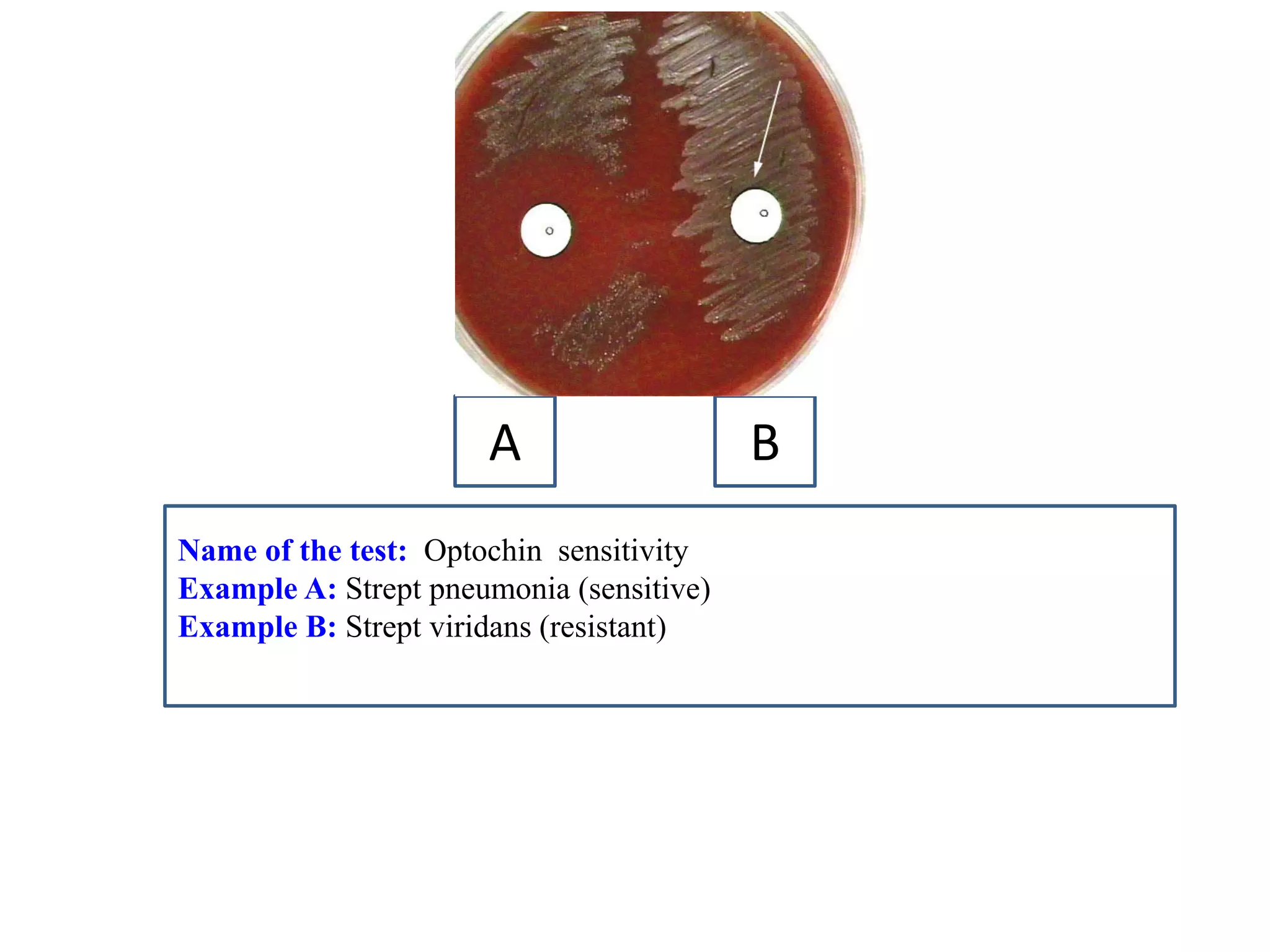 Name of the test: Optochin sensitivity 
Example A: Strept pneumonia (sensitive) 
Example B: Strept viridans (resistant) 
A 
B  