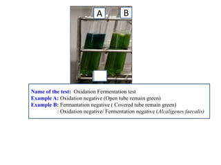 A 
B 
Name of the test: Oxidation Fermentation test 
Example A: Oxidation negative (Open tube remain green) 
Example B: Fermantation negative ( Covered tube remain green) 
: Oxidation negative/ Fermentation negative (Alcaligenes faecalis) 
 