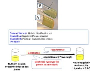 Name of the test: Gelatin Liquification test 
Example A: Negative (Proteus species) 
Example B: Positive ( Pseudomonas species) 
Principle : 
Nutrient gelatin 
Protein/Polypeptides 
Solid 
Gelatinase 
Incubation at 37/overnight 
Nutrient gelatin 
Amino acids 
Liquid at > 25 C 
Gelatinase hydrolyze the protein to aminoacids 
Pseudomonas 
A 
B  