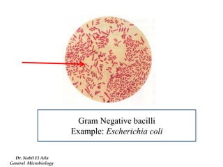 Gram Negative bacilli 
Example: Escherichia coli 
Dr. Nabil El Aila 
General Microbiology  