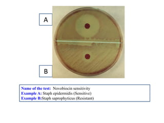 Name of the test: Novobiocin sensitivity 
Example A: Staph epidermidis (Sensitive) 
Example B:Staph saprophyticus (Resistant) 
A 
B  
