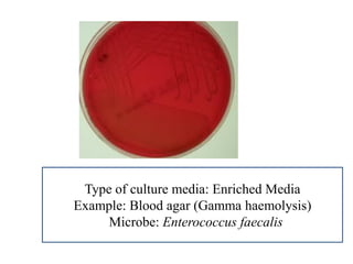 Type of culture media: Enriched Media 
Example: Blood agar (Gamma haemolysis) 
Microbe: Enterococcus faecalis  