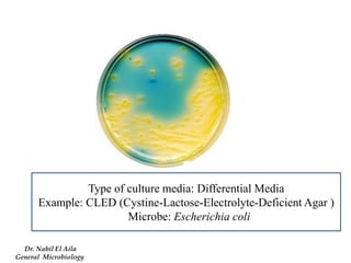 Type of culture media: Differential Media 
Example: CLED (Cystine-Lactose-Electrolyte-Deficient Agar ) 
Microbe: Escherichia coli 
Dr. Nabil El Aila 
General Microbiology  