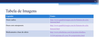 Tabela de Imagens
75
Legenda: Fonte:
Ossos sadios. http://www.quadrilcirurgia.com.br/fraturas-do-colo-
femoral.html
Ossos com osteoposore. http://www.quadrilcirurgia.com.br/fraturas-do-colo-
femoral.html
Medicamento a base de cálcio http://www.ultrafarma.com.br/produto/detalhes-
11534/calcitran-d3-com-30-comprimidos.html
 