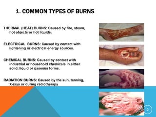 Slides first aid burns mgt | PPTX
