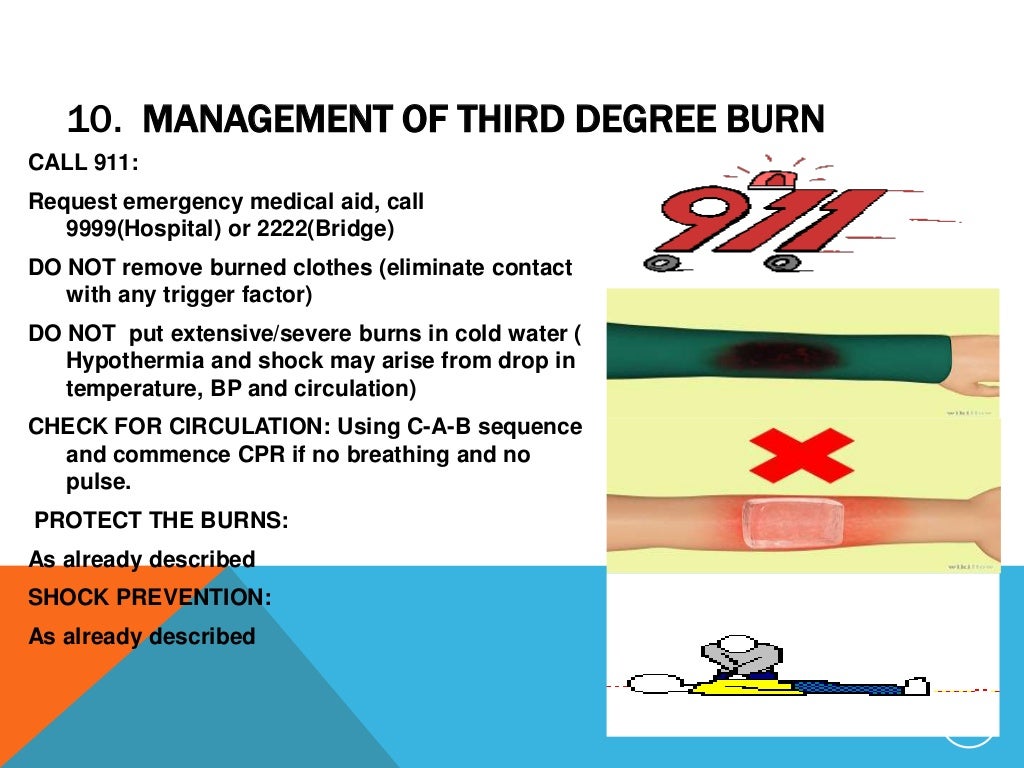 Slides first aid burns mgt