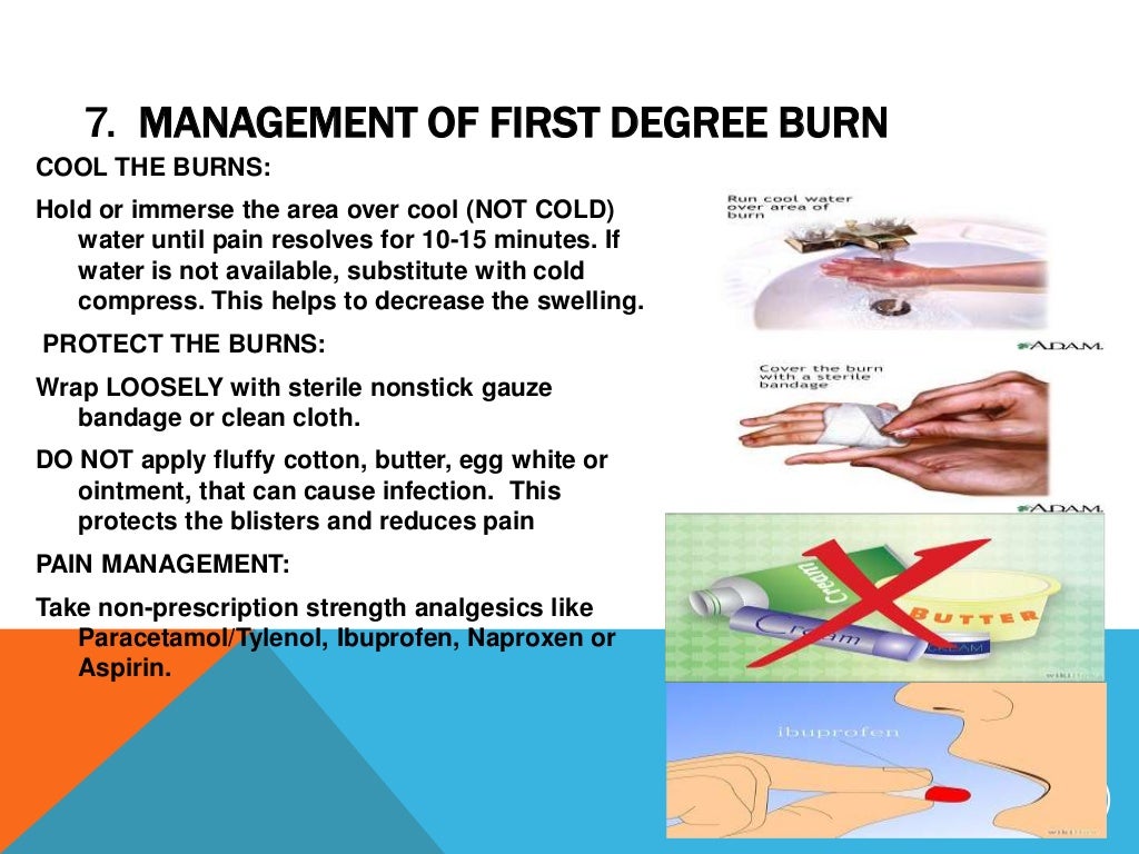 Slides first aid burns mgt