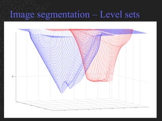 Image segmentation – Level sets 