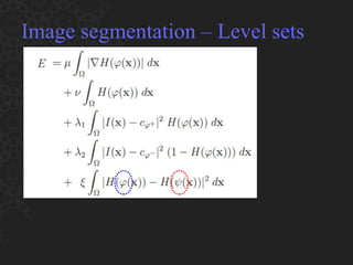 Image segmentation – Level sets 