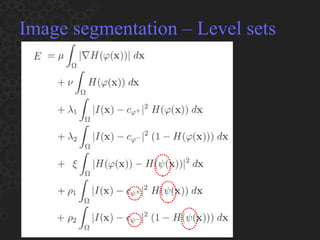 Image segmentation – Level sets 