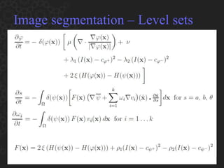 Image segmentation – Level sets 