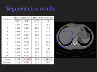 Segmentation results 
