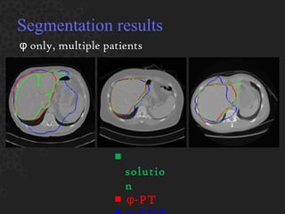 Segmentation results ■  solution  ■  φ -PT  ■  φ -SDT φ  only, multiple patients 