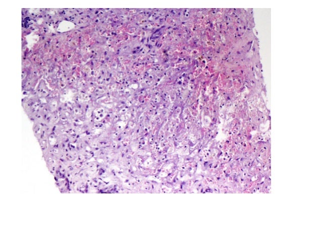 liver slide