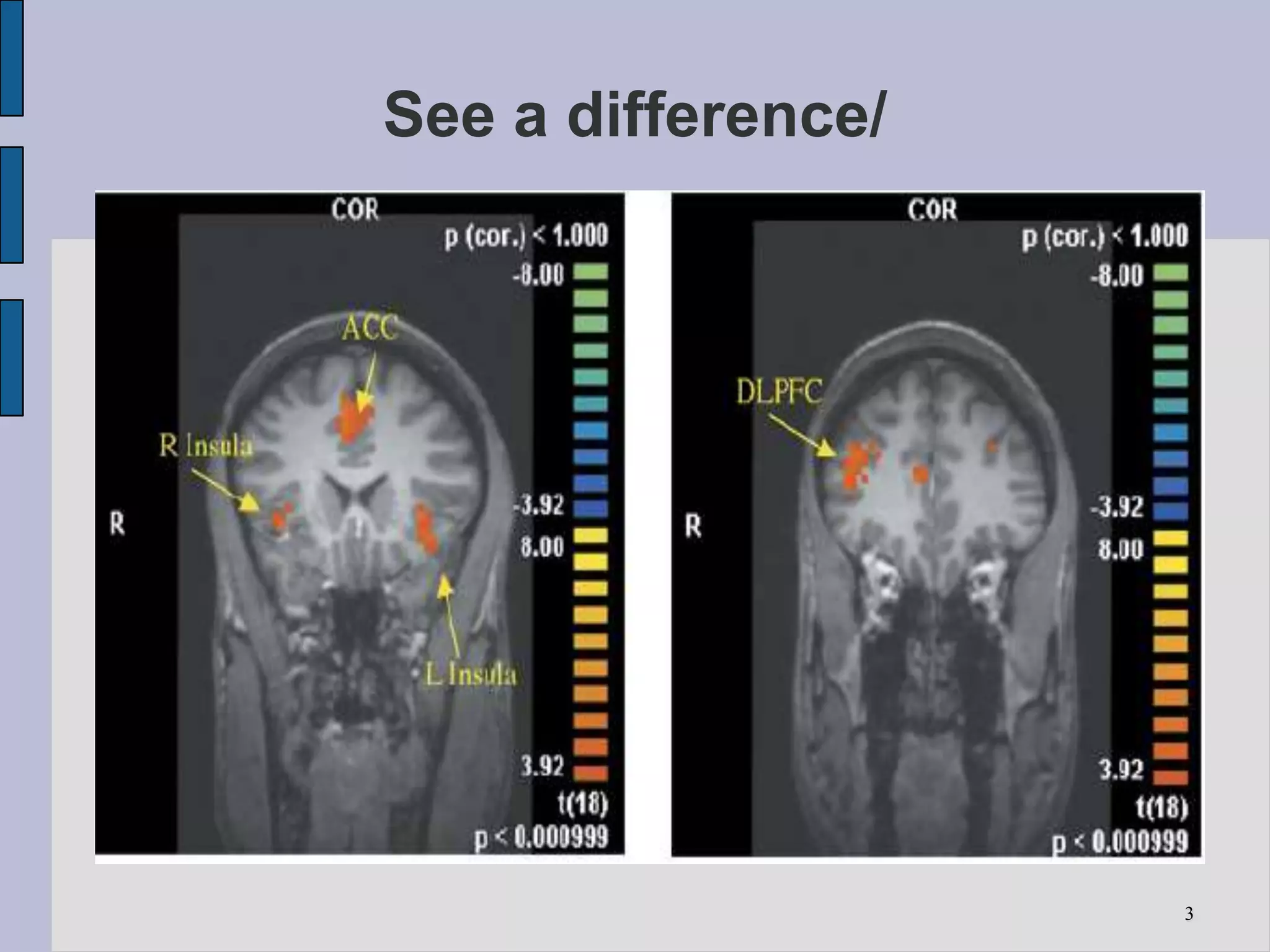 See a difference/




                    3
 