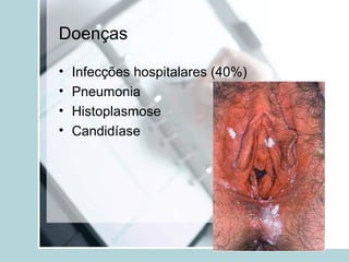 Doenças
• Infecções hospitalares (40%)
• Pneumonia
• Histoplasmose
• Candidíase
 