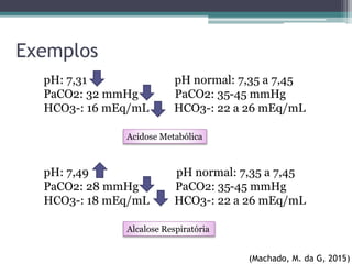 Exemplos
pH: 7,31 pH normal: 7,35 a 7,45
PaCO2: 32 mmHg PaCO2: 35-45 mmHg
HCO3-: 16 mEq/mL HCO3-: 22 a 26 mEq/mL
Acidose Metabólica
(Machado, M. da G, 2015)
pH: 7,49 pH normal: 7,35 a 7,45
PaCO2: 28 mmHg PaCO2: 35-45 mmHg
HCO3-: 18 mEq/mL HCO3-: 22 a 26 mEq/mL
Alcalose Respiratória
 