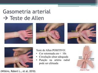 Gasometria arterial
 Teste de Allen
Teste de Allen POSITIVO:
• Cor retormada em < 10s
• Circulação ulnar adequada
• Punção na artéria radial
pode ser efetuada
(Wilkins, Robert L., et al, 2010)
 