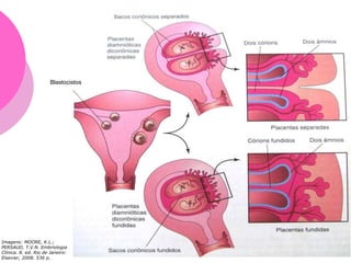 Imagens: MOORE, K.L.;
PERSAUD, T.V.N. Embriologia
Clínica. 8. ed. Rio de Janeiro:
Elsevier, 2008. 536 p.
Blastocistos
 