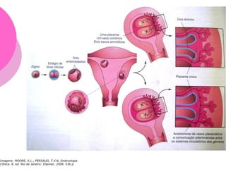 Imagens: MOORE, K.L.; PERSAUD, T.V.N. Embriologia
Clínica. 8. ed. Rio de Janeiro: Elsevier, 2008. 536 p.
 