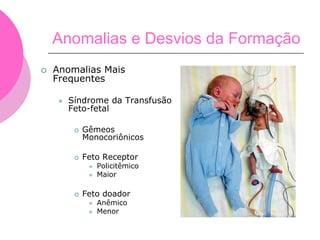 Anomalias e Desvios da Formação
 Anomalias Mais
Frequentes
 Síndrome da Transfusão
Feto-fetal
 Gêmeos
Monocoriônicos
 Feto Receptor
 Policitêmico
 Maior
 Feto doador
 Anêmico
 Menor
 