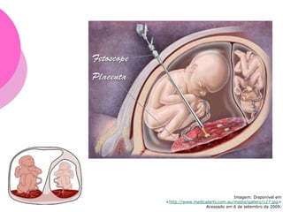 Imagem: Disponível em
<http://www.medicalarts.com.au/media/gallery/127.jpg>
Acessado em 6 de setembro de 2009.
 