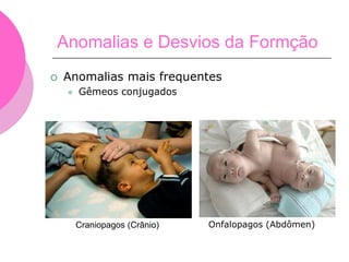  Anomalias mais frequentes
 Gêmeos conjugados
Onfalopagos (Abdômen)
Craniopagos (Crânio)
Anomalias e Desvios da Formção
 