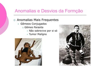  Anomalias Mais Frequentes
 Gêmeos Conjugados
 Gêmeo Parasita
 Não sobrevive por si só
 Tumor Malígno
Anomalias e Desvios da Formção
 