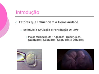 Introdução
 Fatores que Influenciam a Gemelaridade
 Estímulo a Ovulação e Fertilização in vitro
 Maior formação de Trigêmios, Quádruplos,
Quíntuplos, Sêxtuplos, Séptuplos e Óctuplos
 