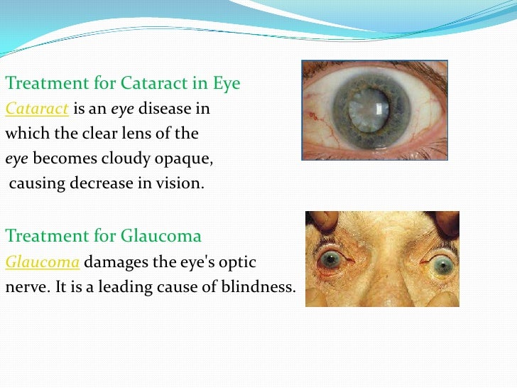 What is myopic eye disease?