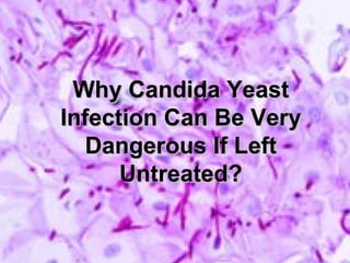 Why Candida Yeast Infection Can Be Very Dangerous If Left Untreated? 