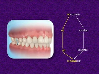 Classification of Malocclusion | PPTX