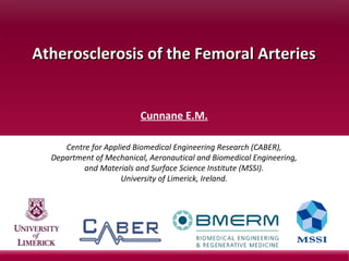 Atherosclerosis of the Femoral ArteriesAtherosclerosis of the Femoral Arteries
Cunnane E.M.
Centre for Applied Biomedical Engineering Research (CABER),
Department of Mechanical, Aeronautical and Biomedical Engineering,
and Materials and Surface Science Institute (MSSI).
University of Limerick, Ireland.
 