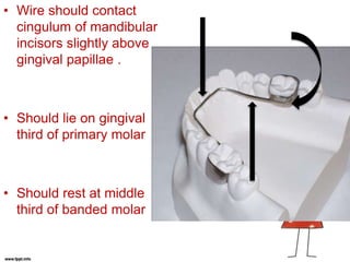 • Wire should contact
cingulum of mandibular
incisors slightly above
gingival papillae .
• Should lie on gingival
third of primary molar
• Should rest at middle
third of banded molar
 