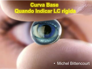 + Curva Base
Quando Indicar LC rígida
• Michel Bittencourt
 