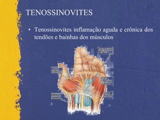TENOSSINOVITES
• Tenossinovites inflamação aguda e crônica dos
tendões e bainhas dos músculos
 