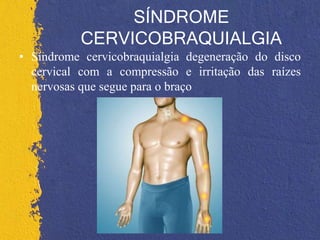 SÍNDROME
CERVICOBRAQUIALGIA
• Síndrome cervicobraquialgia degeneração do disco
cervical com a compressão e irritação das raízes
nervosas que segue para o braço
 