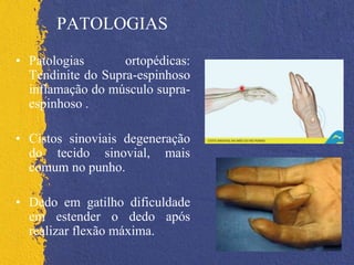 PATOLOGIAS
• Patologias ortopédicas:
Tendinite do Supra-espinhoso
inflamação do músculo supra-
espinhoso .
• Cistos sinoviais degeneração
do tecido sinovial, mais
comum no punho.
• Dedo em gatilho dificuldade
em estender o dedo após
realizar flexão máxima.
 