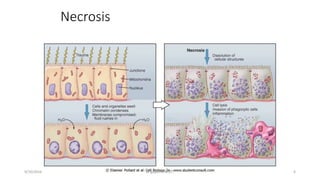 Necrosis
6
 