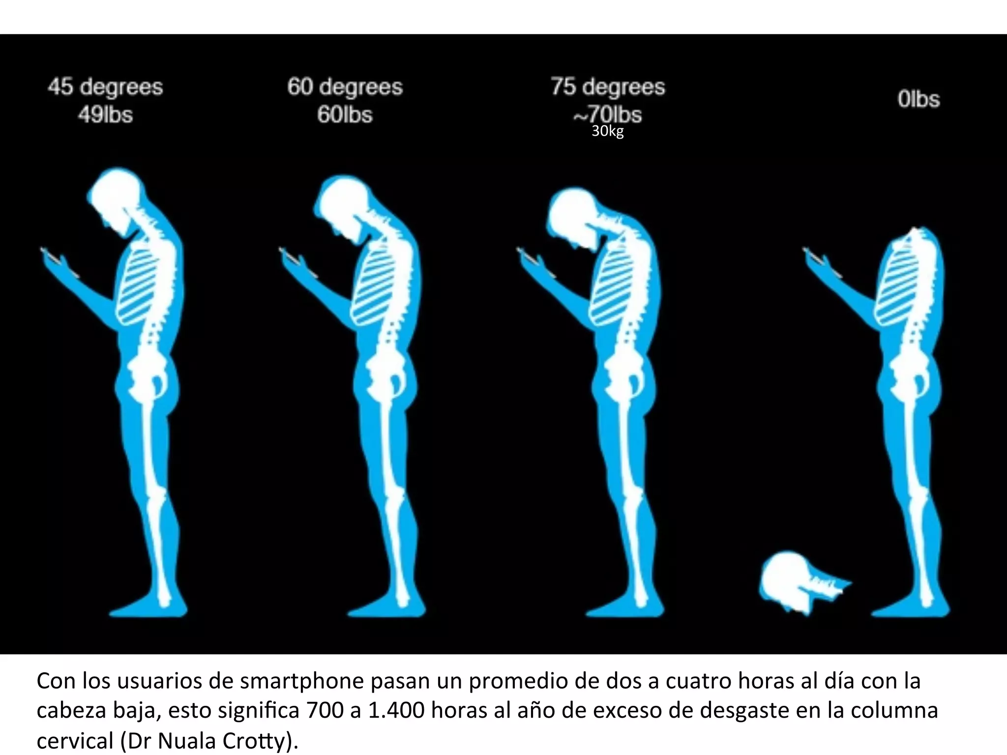 Con	los	usuarios	de	smartphone	pasan	un	promedio	de	dos	a	cuatro	horas	al	día	con	la	
cabeza	baja,	esto	signiﬁca	700	a	1.400	horas	al	año	de	exceso	de	desgaste	en	la	columna	
cervical	(Dr	Nuala	CroMy).	
30kg	
 