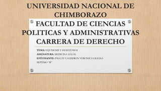 UNIVERSIDAD NACIONAL DE
CHIMBORAZO
FACULTAD DE CIENCIAS
POLITICAS Y ADMINISTRATIVAS
CARRERA DE DERECHO
TEMA: EQUIMOSIS Y HEMATOMAS
ASIGNATURA: MEDICINA LEGAL
ESTUDIANTE: PAGUAY CALDERON VERONICA LILIANA
SEPTIMO “B”
 
