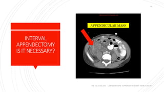 INTERVAL
APPENDECTOMY
ISITNECESSARY?
DR. AL-GAILANI LAPAROSCOPIC APPENDICECTOMY: HOW I DO IT?
15
APPENDICULAR MASS
 