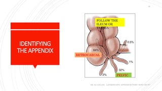 IDENTIFYING
THEAPPENDIX
DR. AL-GAILANI LAPAROSCOPIC APPENDICECTOMY: HOW I DO IT?
28
RETROCAECAL
PELVIC
FOLLOW THE
ILEUM OR
TAENIA
 